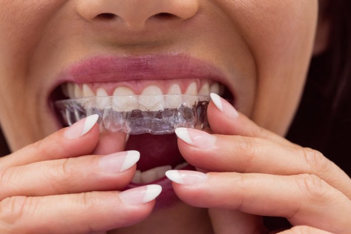 Questions to Ask Your Dentist Before Your Invisalign Treatment